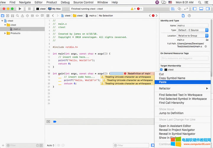 �� OneNote ճ�N���a�� Xcode���l(f��)�F(xi��n)���a�e(cu��)�`